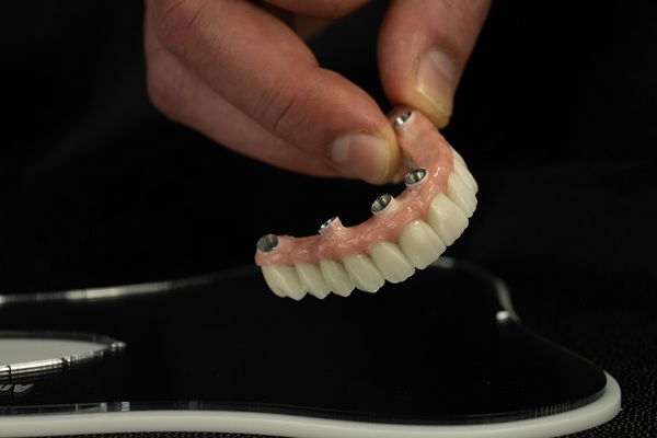 Do All On  ® Implants Look Natural?